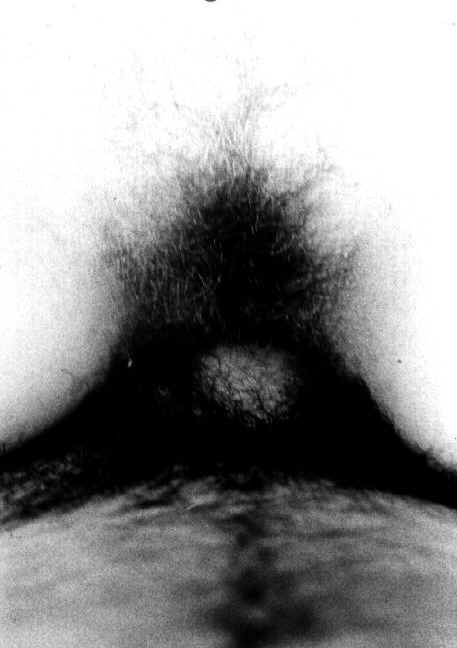 Entre-cama Entre-cama